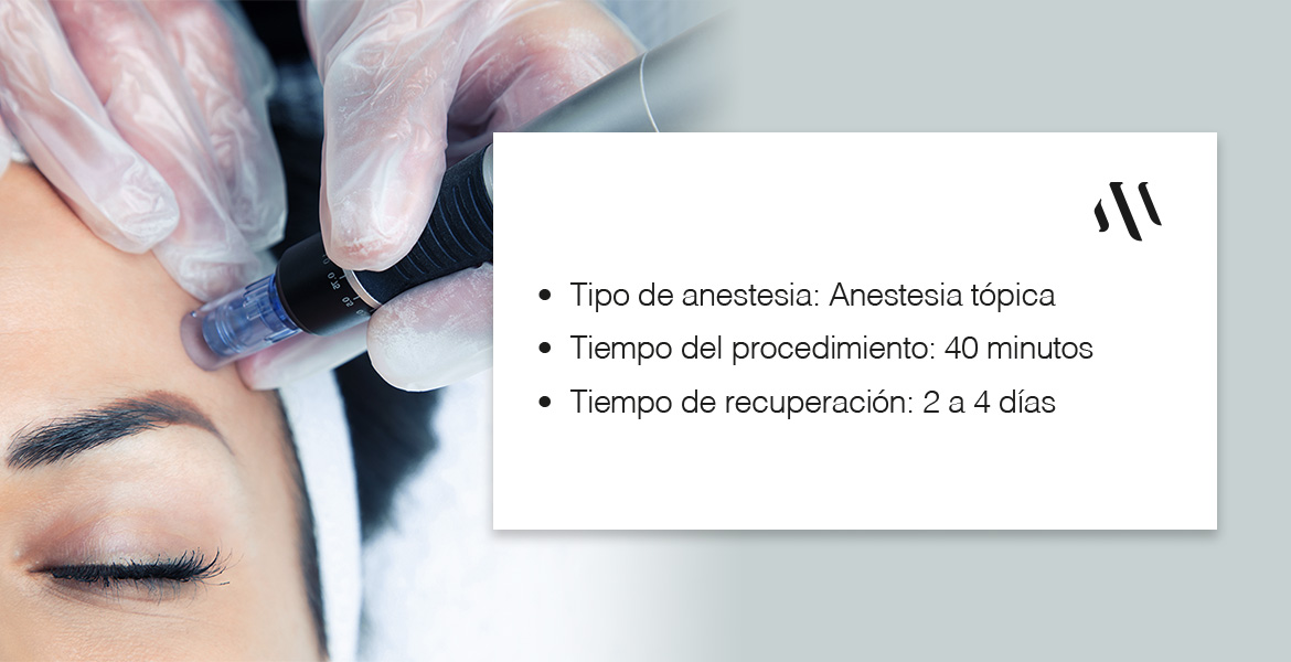 PROC-INT-Micro-Needling