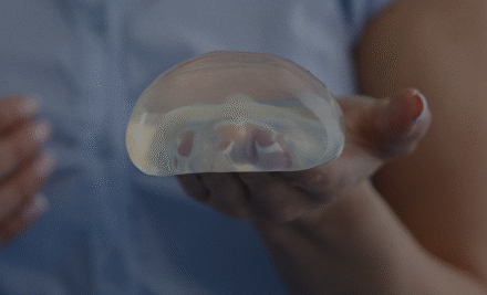 Breast Augmentation Surgery: everything you need to know